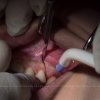 Interventi